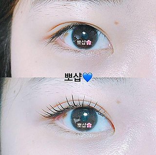 뷰러펌 thumbnail image