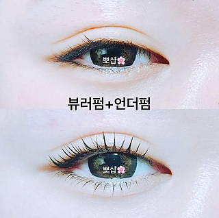 뷰러펌 thumbnail image