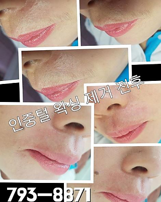 인중왁싱 thumbnail image