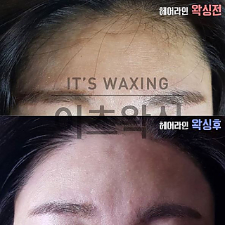 헤어라인왁싱 thumbnail image