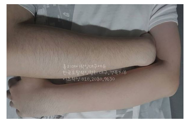 대표이미지
