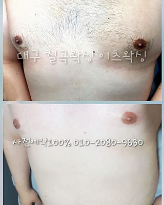 남성 바디왁싱 thumbnail image