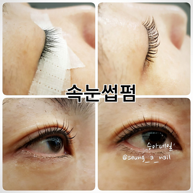 서브이미지