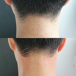 뒷목왁싱 thumbnail image