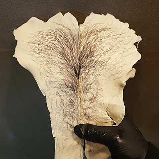 저자극 저통증으로 빠르게 브라질리언왁싱 thumbnail image