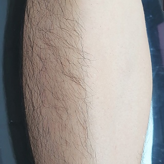 다리 왁싱 thumbnail image