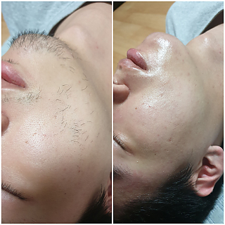 수원남자수염왁싱 thumbnail image