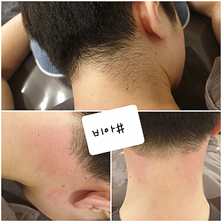뒷목왁싱 thumbnail image