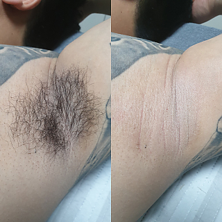 청결을위해 왁싱하세용 thumbnail image